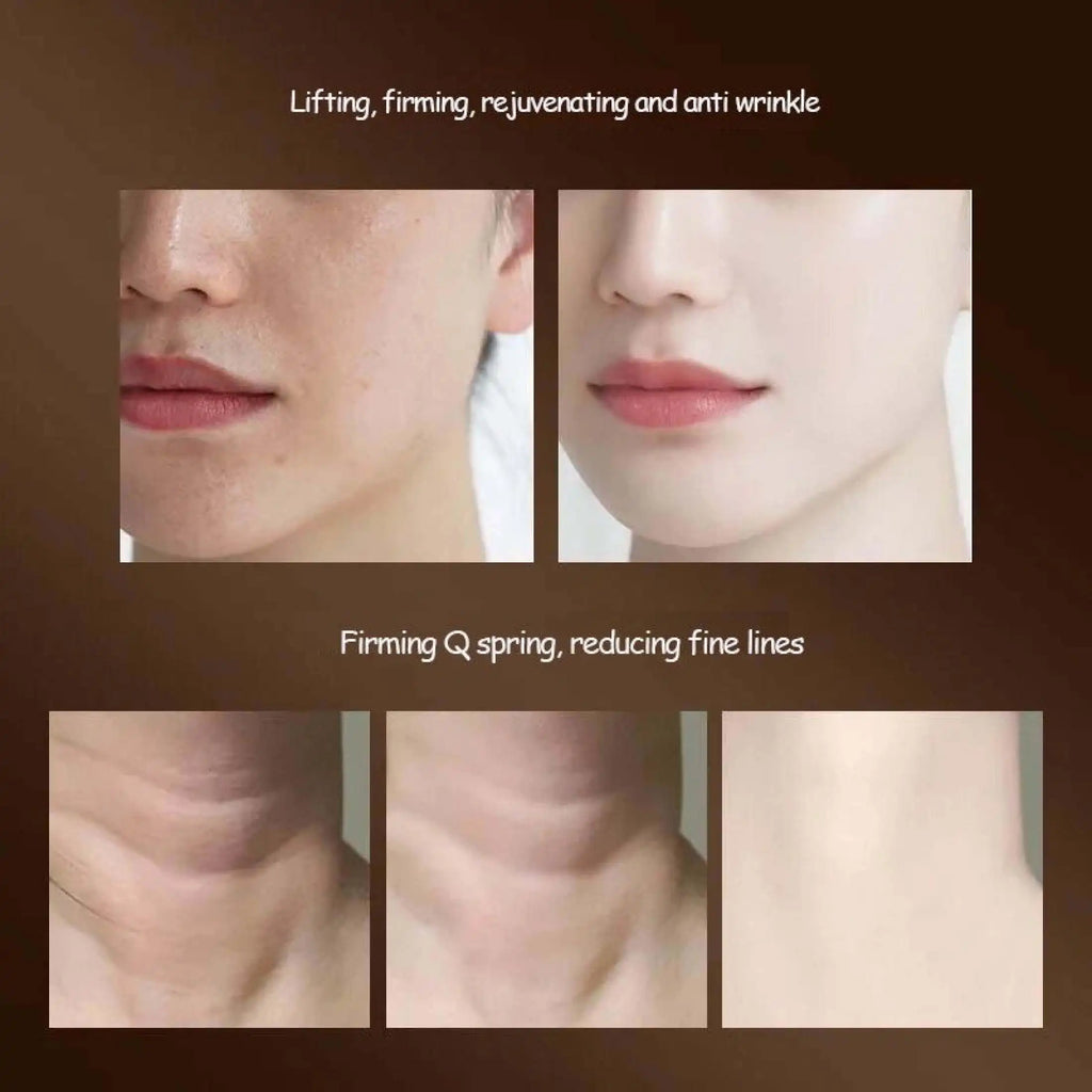 Serene™ Tri-Lift - 3-in-1 Lymphatic Face & Neck Sculptor